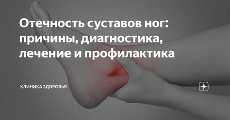 Отечность ноги: симптомы и диагностика