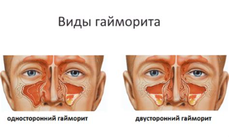 Парень и трогание носа: что оно значит?