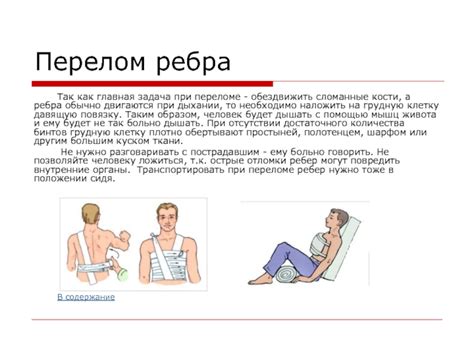 Первая помощь при растяжении ребра