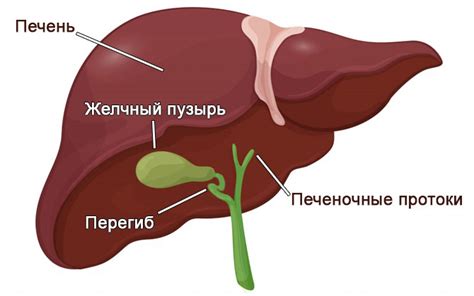 Перегиб в шейке желчного пузыря: симптомы, причины, лечение