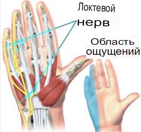 Перинейропатия локтевого нерва