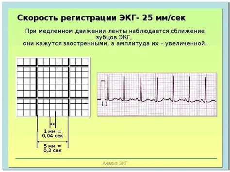 Печатная лента для записи ЭКГ