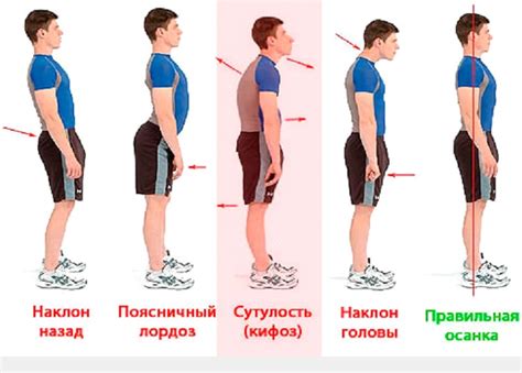 Плохая осанка и долгое сидение