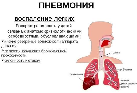 Пневмония и легочные осложнения