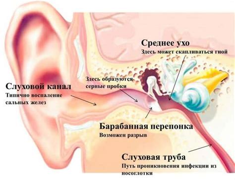 Повреждение барабанной перепонки: что делать и как избежать