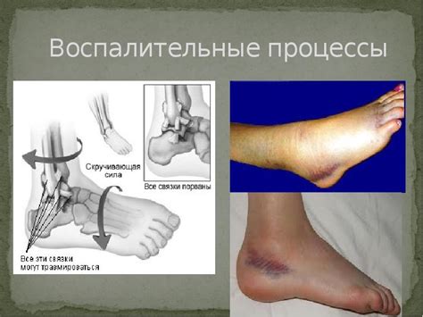 Повреждение стопы или голени нежелательно