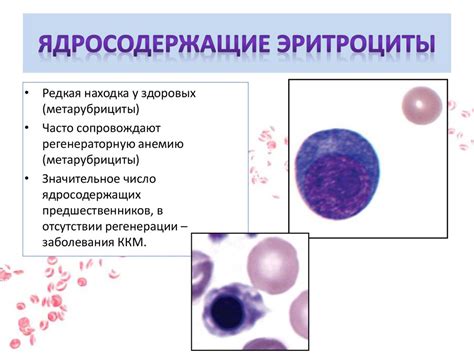 Повышенная продукция эритроцитов