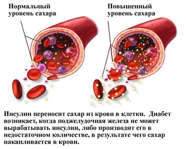 Повышенный сахар в крови и сердечно-сосудистые заболевания