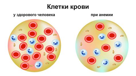 Повышенный уровень гемоглобина в крови: что это такое?