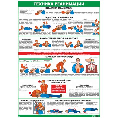 Подготовка к реанимации