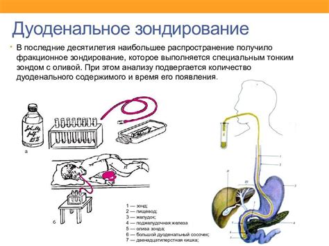 Показания для проведения дуоденального зондирования