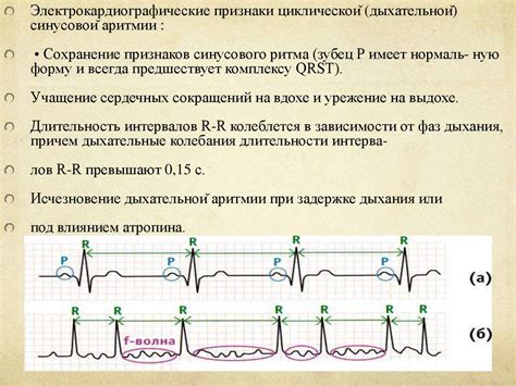 Понимание синусовой аритмии