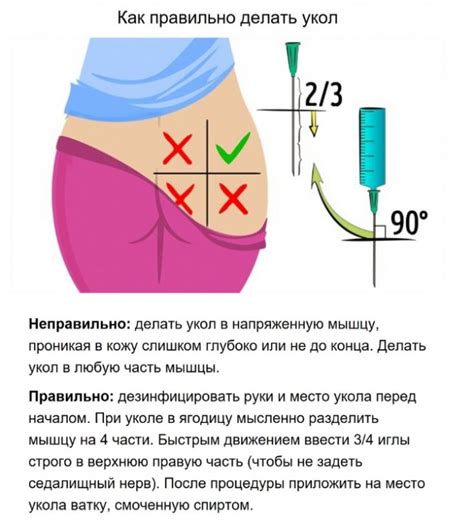 Последствия введения воздуха в ягодицу