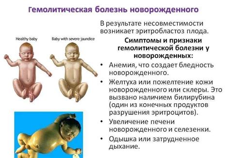 Последствия и прогноз для плода с дефектом