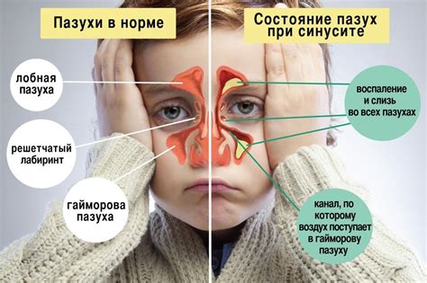 Последствия и рекомендации после кукушки для носа у детей