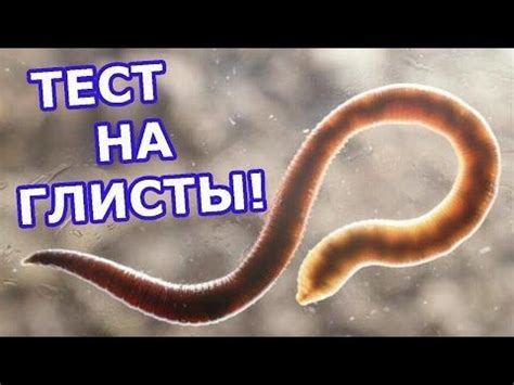 Почему важно проверять наличие глистов?