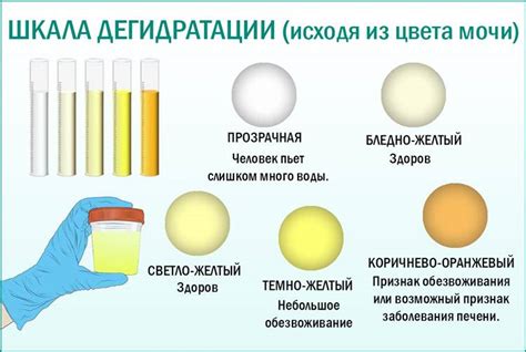 Почему моча оранжевого цвета