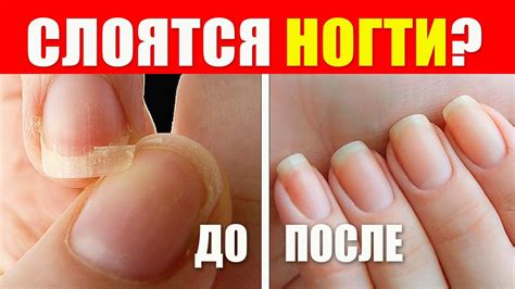 Почему ногти гнутся и ломаются?