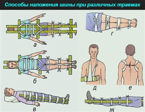 Предотвращение повторного повреждения