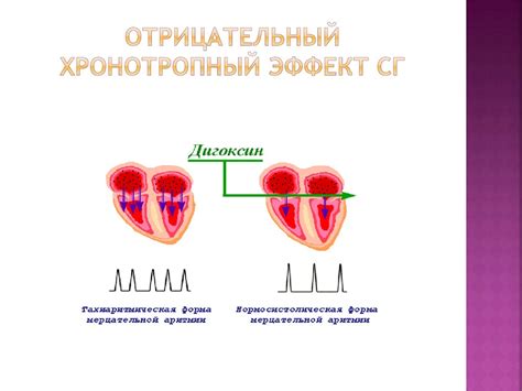 Принципы сердечной ритмологии