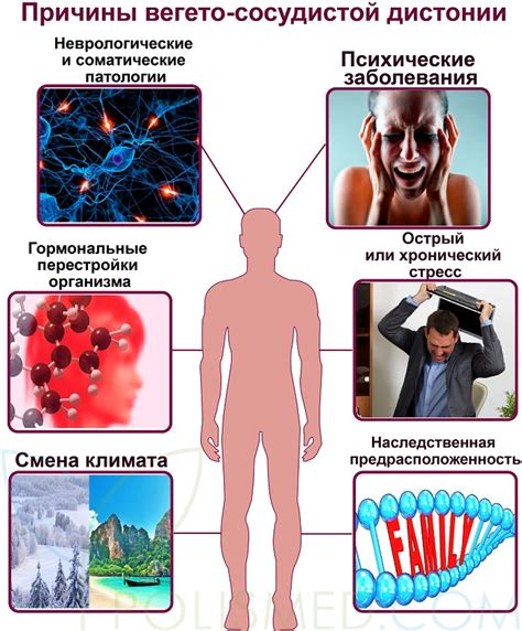 Причины вегето-сосудистой дистонии