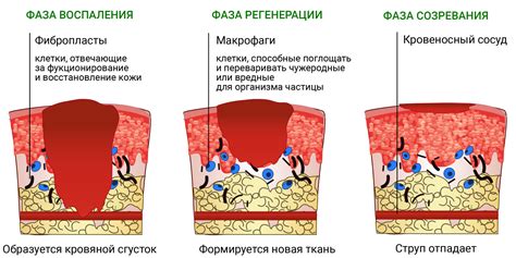 Причины возникновения ожогов от мазей