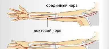 Причины возникновения онемения