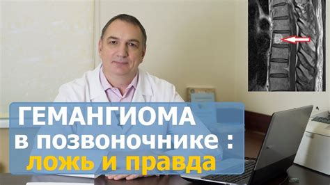 Причины гемангиомы L1 позвоночника поясничного отдела