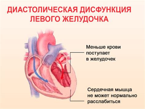 Причины диастолической дисфункции левого желудочка 1 степени