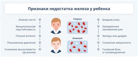 Причины и симптомы анемии у ребенка 16 лет