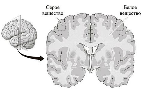 Причины легких диффузных изменений белого вещества головного мозга