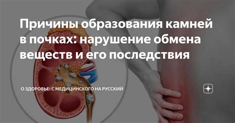 Причины образования камней в почках