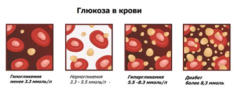 Причины повышенного уровня глюкозы в крови