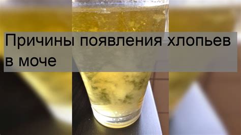 Причины появления хлопьев в моче