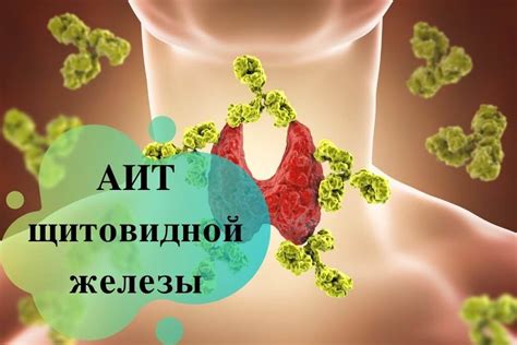 Причины развития аутоиммунного тиреоидита (АИТ)