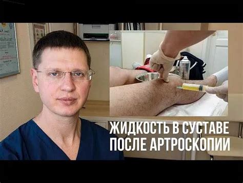 Причины скопления жидкости под коленкой