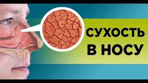 Причины сухости в носу