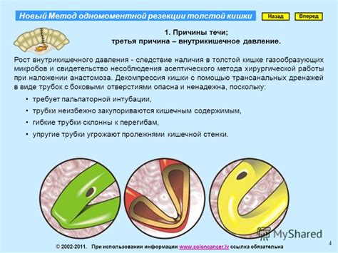 Причины течи глаз