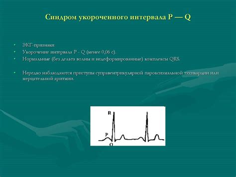 Причины укорочения pq-интервала у ребенка