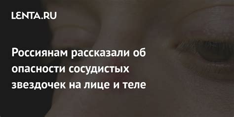 Проблемы, которые могут возникнуть при наличии сосудистых звездочек