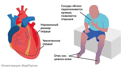 Проблемы с кардиограммой: что означает блокада сердца?