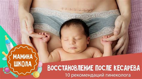 Продукты, которые рекомендуется употреблять после кесарева сечения