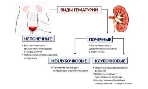 Простатит и ошметки в моче: