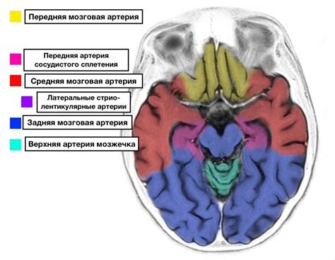 Профилактика расширения базальных цистерн головного мозга