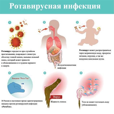 Проявления ротовирусной инфекции