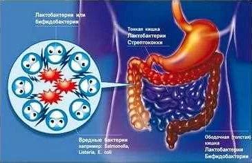 Развитие дисбактериоза и нарушение синтеза холестирина