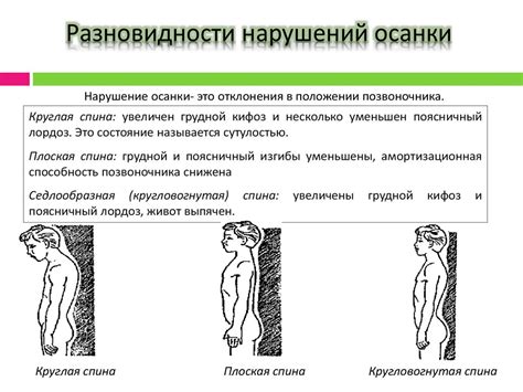 Разновидности осанки, и почему надо заниматься именно ими