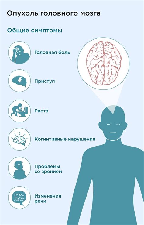 Расстройства работы неспецифических срединных структур головного мозга: причины и симптомы