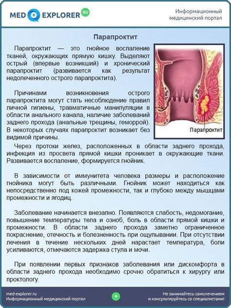 Рекомендации для предотвращения дискомфорта в заднем проходе