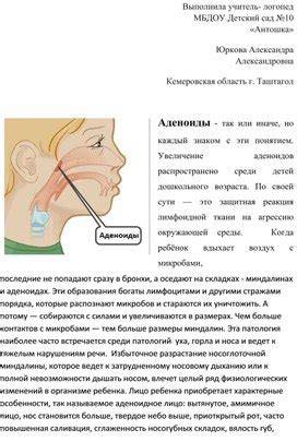 Речевые нарушения и необходимые исследования